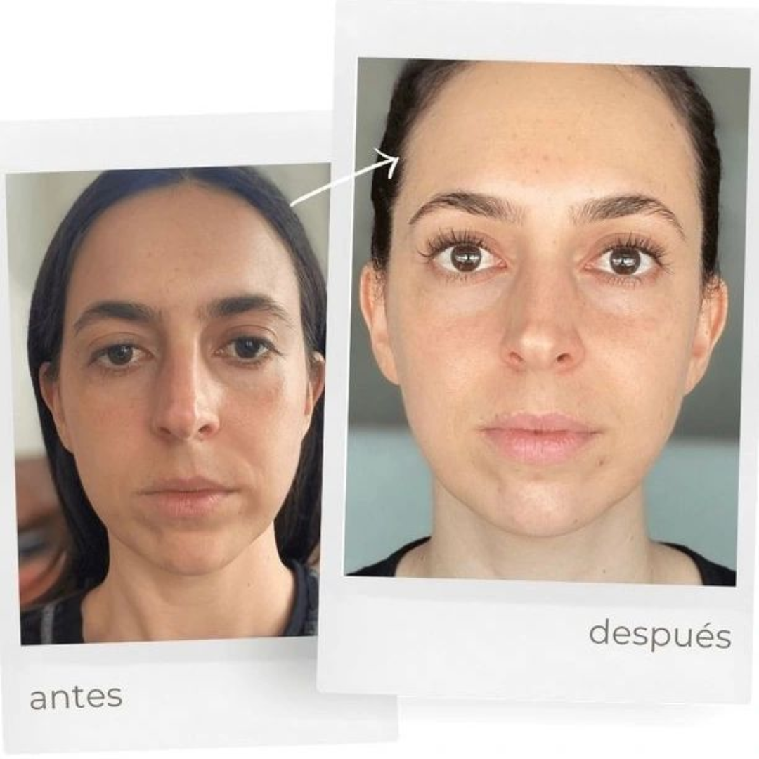 Resultado antes y después 1
