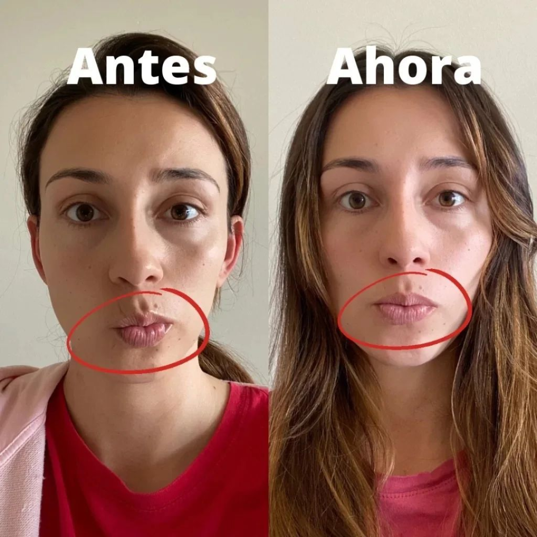 Resultado antes y después 5