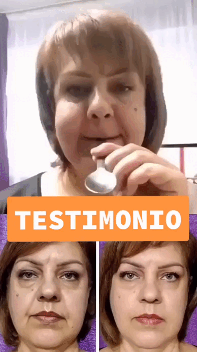 Resultado antes y después animado